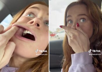 A TikToker captured the moment a flower seed ‘popped out’ of her cheek after being lodged there for three weeks, as followers breathed a sigh of relief