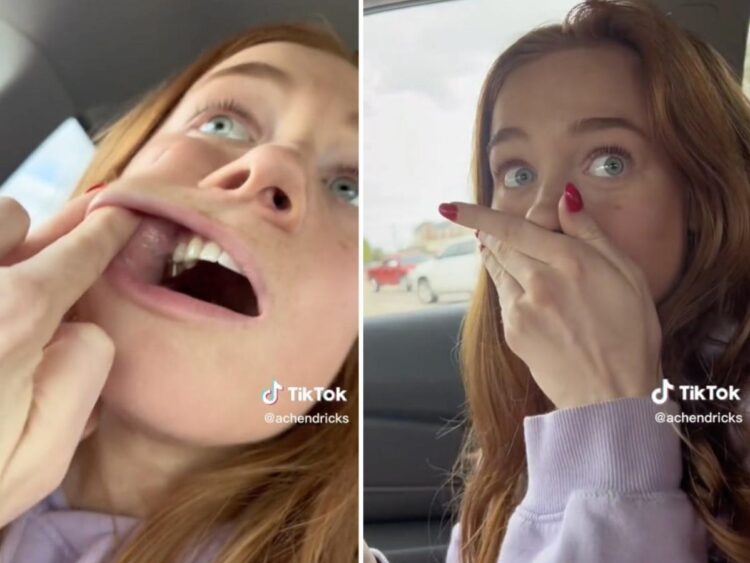 A TikToker captured the moment a flower seed ‘popped out’ of her cheek after being lodged there for three weeks, as followers breathed a sigh of relief