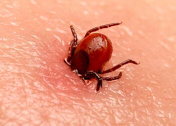 People in 8 states should be aware of the signs of yet another tick-borne disease as cases rise, CDC says