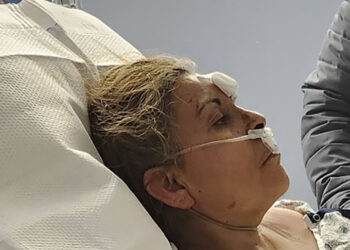 Factory explosion survivor, on fire, fell into chocolate vat