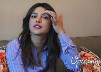Priyanka Chopra Jonas Details Face Injury From Citadel Set
