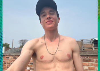 Elliot Page, in shirtless photo, celebrates the end of ‘dysphoria.’ Here’s what it means.