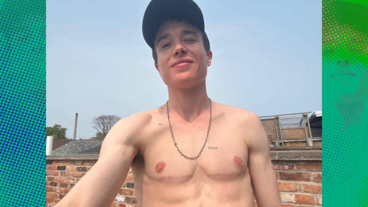 Elliot Page, in shirtless photo, celebrates the end of ‘dysphoria.’ Here’s what it means.