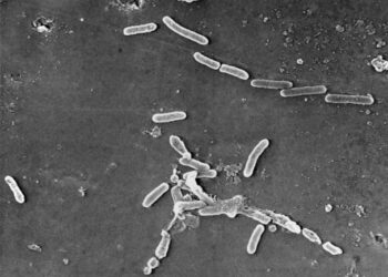 Contaminated eye drops linked to more deaths as 14 people report vision loss