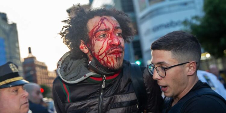 Eric Adams Says ‘Agitators That Came From Outside Our City’ Planted Molotov Cocktail at Jordan Neely Protest