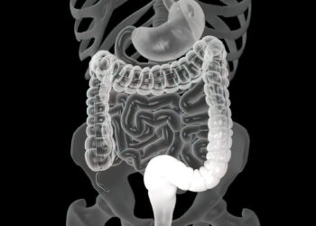 You’re not too young for colon cancer. New research identifies the 4 earliest symptoms