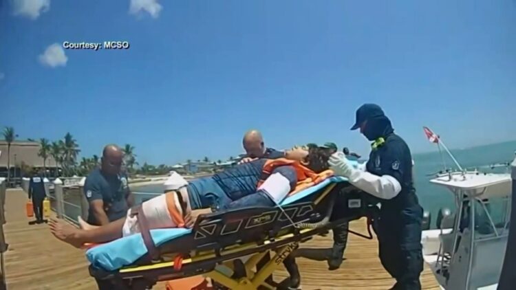 Gruesome photos show man’s leg after shark attack 70 feet underwater