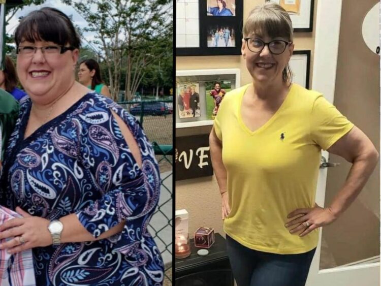 A woman who lost 176 pounds taking Ozempic competitor Mounjaro is petrified of putting the weight back on when she can’t afford to pay $1000 a month