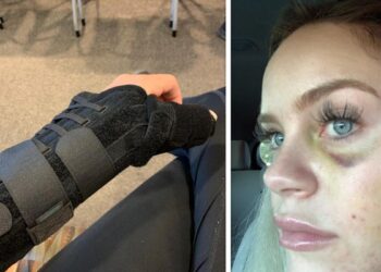 California man who pummeled, shot at female deputy found not guilty despite video of attack