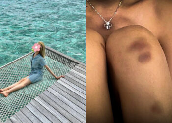 Chinese student says she was sexually assaulted by butler at Ritz-Carlton hotel in Maldives, forced to leave without apology