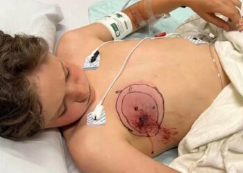 11-Year-Old Bitten by Rattlesnake After Falling Off Bike on Colorado Trail: ‘He’s a Tough Boy’