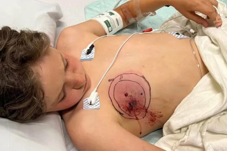 11-Year-Old Bitten by Rattlesnake After Falling Off Bike on Colorado Trail: ‘He’s a Tough Boy’