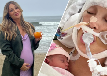 Jackie Miller James, influencer, in coma after aneurysm