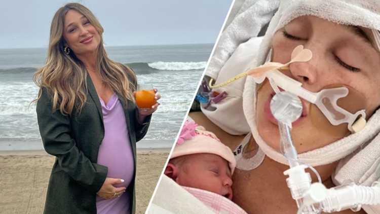 Jackie Miller James, influencer, in coma after aneurysm