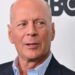Bruce Willis’ family missed a common early dementia symptom—and they’re not alone. 5 ways to tell if it’s more serious than normal aging