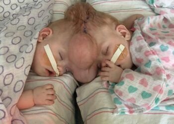 ‘The Sky Is the Limit for Them’ Says Mom