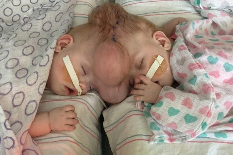 ‘The Sky Is the Limit for Them’ Says Mom