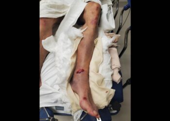 Luke Combs fan says he waited hour for ambulance after attack in Arrowhead parking lot