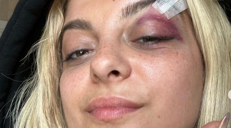 Suspect Allegedly Said He Threw Phone At Bebe Rexha For Troubling Reason